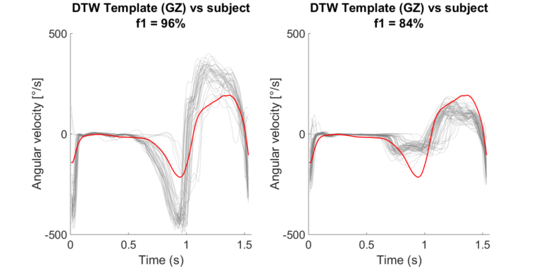 Featured image for Mobile gait analysis for hereditary spastic paraplegia patients