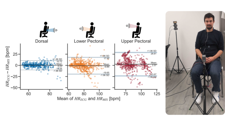 Featured image for Assessment of Micro Movements during Acute Psychosocial Stress